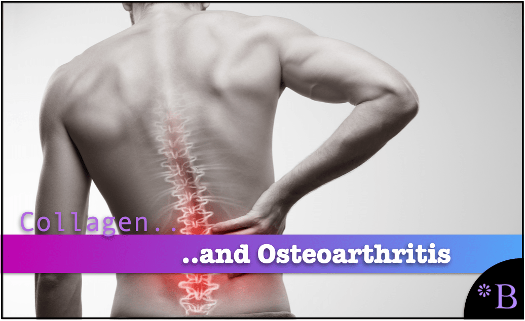 Osteoarthritis and Collagen Health - Brightwork Research Treatment Database